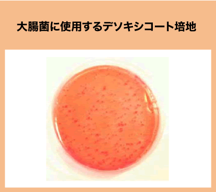 大腸菌に使用するデソキシコート培地