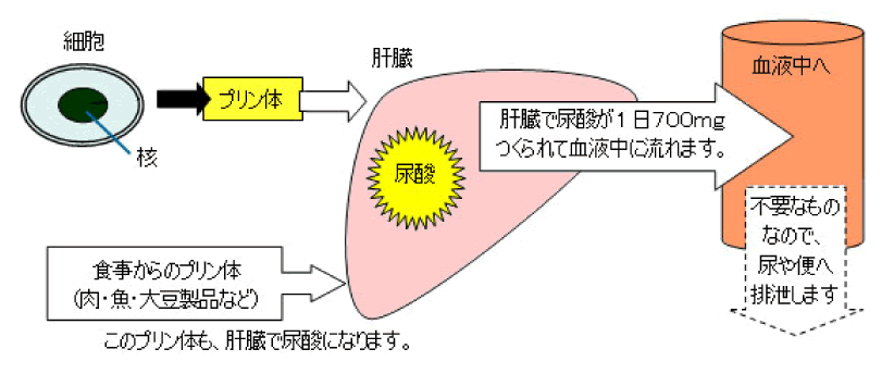 痛風